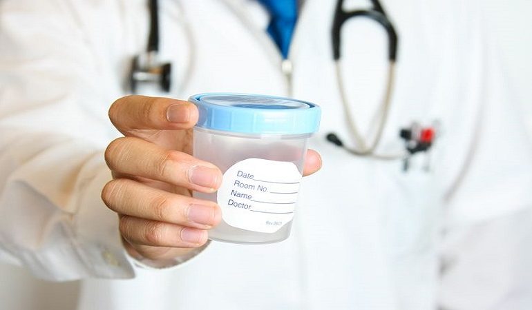 متخصص زنان بجنورد نتیجه آزمایش آنالیز اسپرم و عوامل تاثیرگذار بر نتیجه