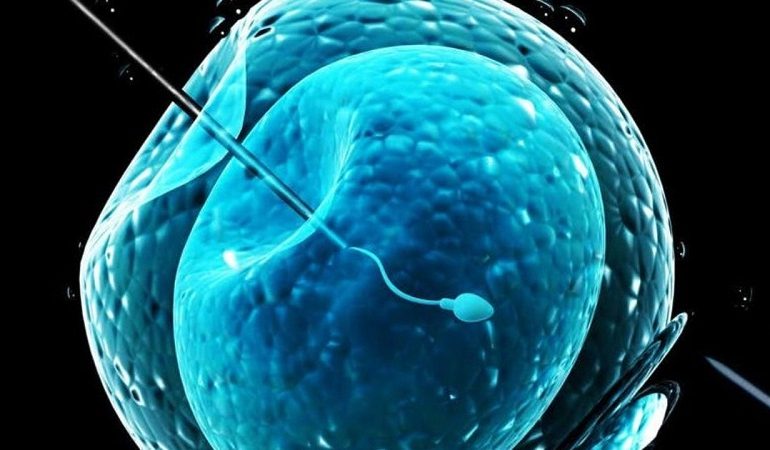 بررسی مراحل انجام روش IVF