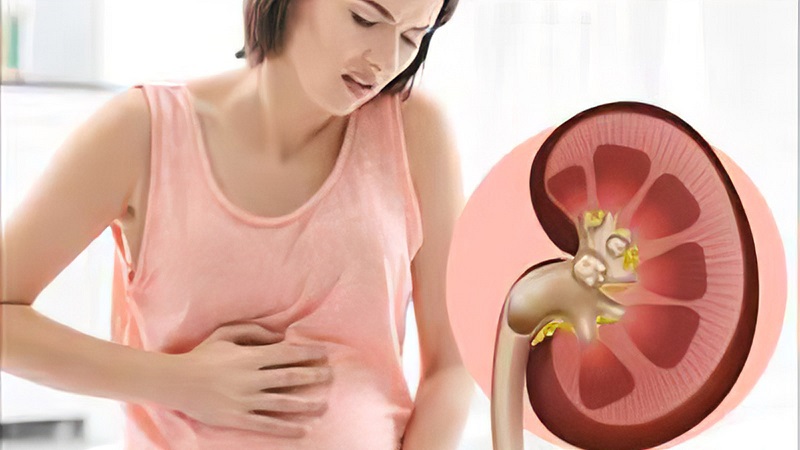 عفونت کلیه در بارداری چیست | متخصص زنان بجنورد