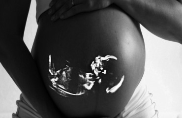 متخصص زنان بجنورد | . چگونگی حرکات جنین در بارداری