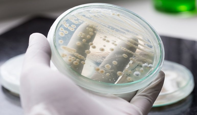 متخصص زنان بجنورد | عارضه برفک واژن
