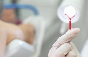 متخصص زنان بجنورد | گذاشتن IUD