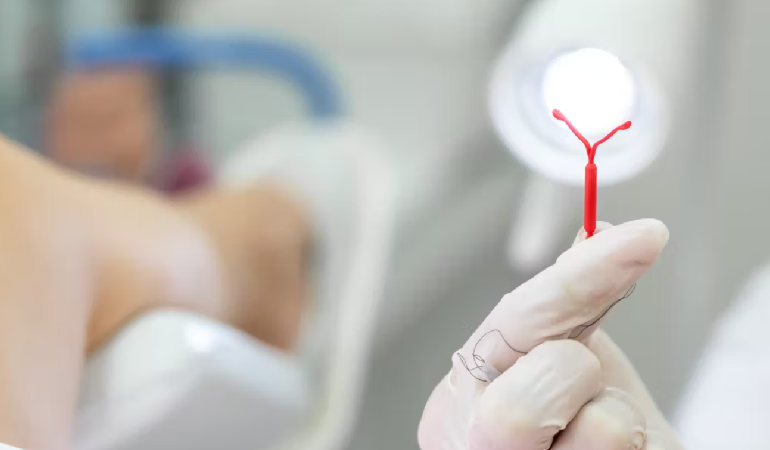 متخصص زنان بجنورد | گذاشتن IUD