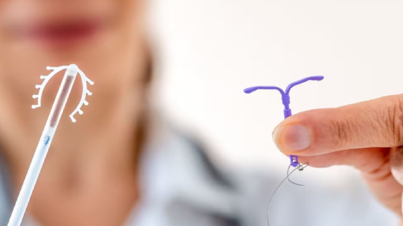 متخصص زنان بجنورد | چگونه برای برداشتن IUD آماده شوم؟