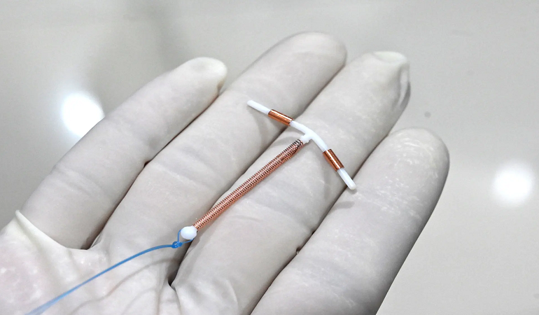 متخصص زنان بجنورد | چگونه برای برداشتن IUD آماده شوم؟