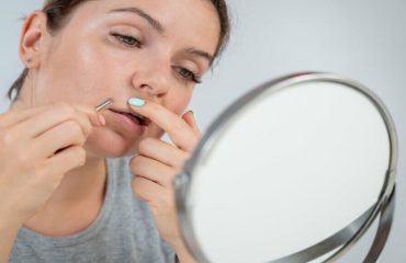 متخصص زنان بجنورد | دلیل اصلی پرمویی در زنان