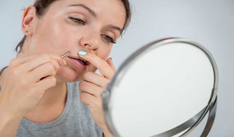 متخصص زنان بجنورد | دلیل اصلی پرمویی در زنان