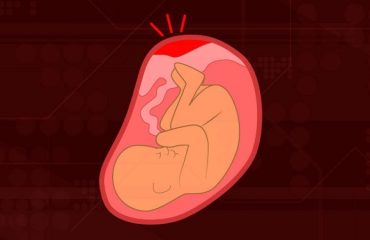متخصص زنان بجنورد | عوامل و علائم جدا شدن زودرس جفت