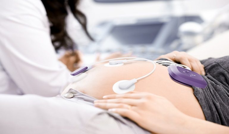 7 دلیل مهم برای انجام تست نوار قلب جنین