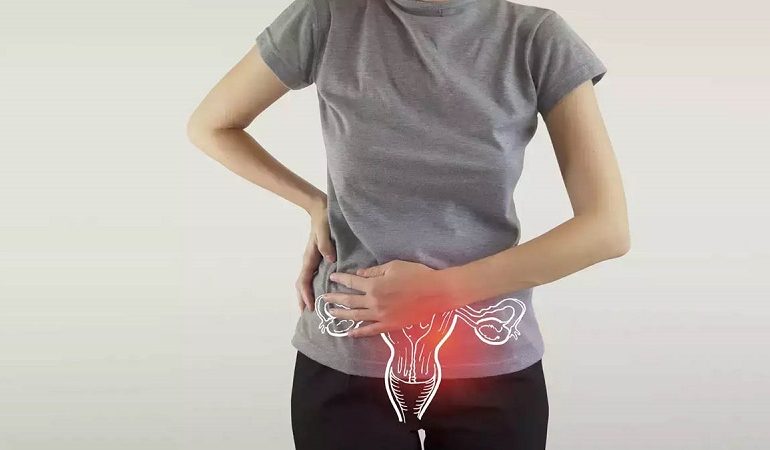 برای درمان دیسپلازی دهانه رحم چه باید کرد ؟